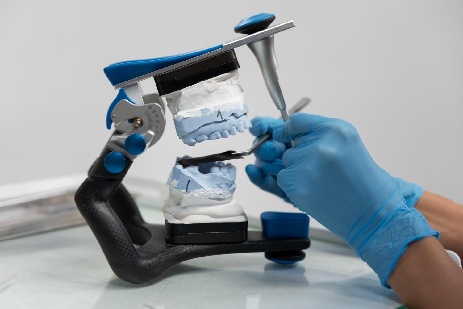 Адгезивные системы в стоматологии: гайд по поколениям бондов