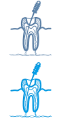 Эндодонтия